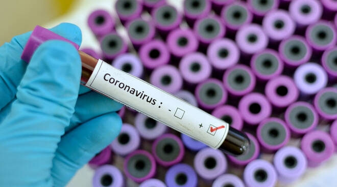 “Coronavirus? Una guerra. Con l’Italia in prima linea”.  Pignotti racconta in un libro i giorni del lockdown